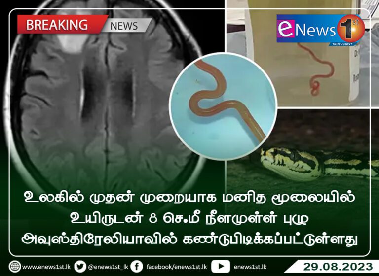 பெண் ஒருவரின் மூளையில் 3 அங்குல புழு உயிருடன்